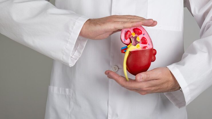 Kidney / Renal Transplantation